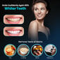Zobu balināšanas komplekts ar 6 gēla šļircēm, MySmile цена и информация | Zobu pastas, birstes | 220.lv