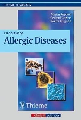 Color Atlas Of Allergic Diseases цена и информация | Svešvalodu mācību materiāli | 220.lv
