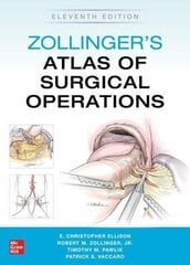 Zollinger's Atlas Of Surgical Operations, Eleventh Edition 11Th Edition цена и информация | Пособия по изучению иностранных языков | 220.lv