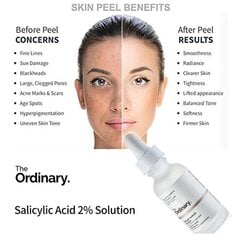 Salicilskābes serums sejai The Ordinary Salicylic Acid 2% Solution, 30ml цена и информация | Сыворотки для лица, масла | 220.lv