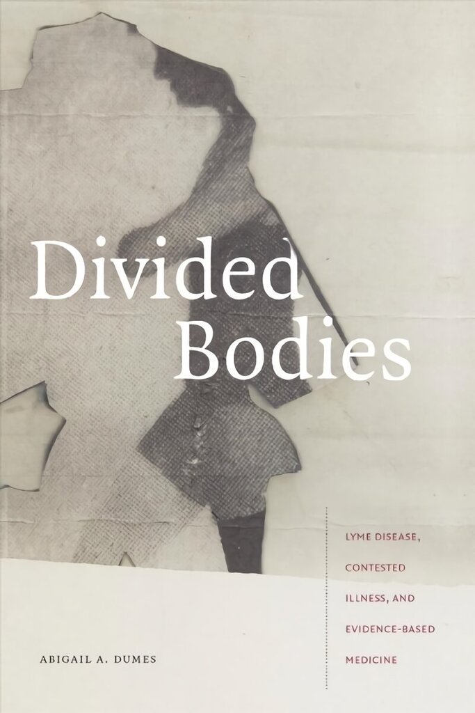Divided Bodies: Lyme Disease, Contested Illness, and Evidence-Based Medicine cena un informācija | Sociālo zinātņu grāmatas | 220.lv
