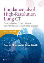 Fundamentals of High-Resolution Lung CT: Common Findings, Common Patterns, Common Diseases and Differential Diagnosis 2nd edition cena un informācija | Ekonomikas grāmatas | 220.lv