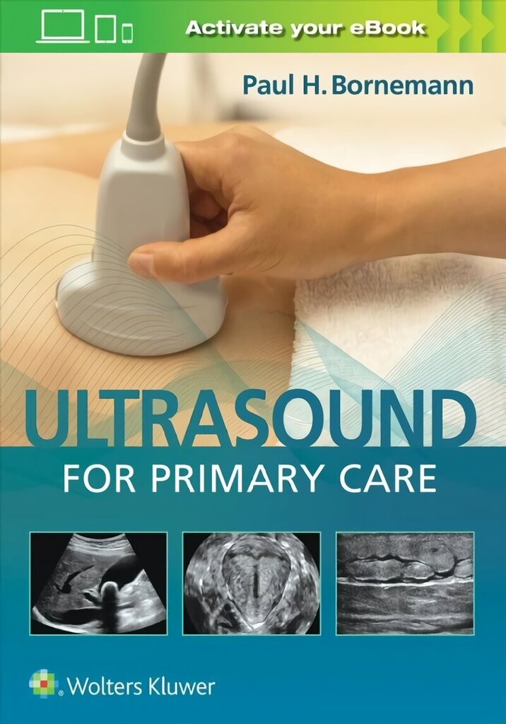 Ultrasound for Primary Care цена и информация | Ekonomikas grāmatas | 220.lv