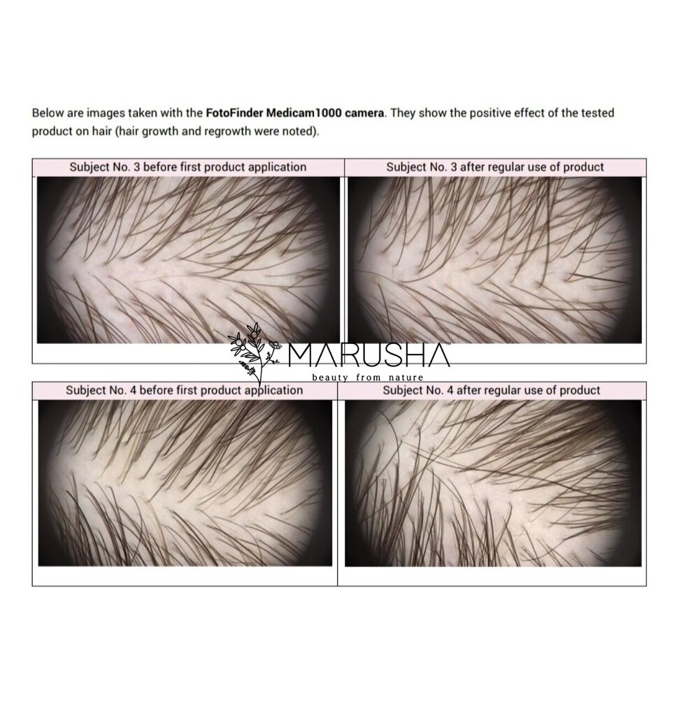 Rozmarīna Matu eļļa matu augšanai, Marusha, 30g cena un informācija | Matu uzlabošanai | 220.lv