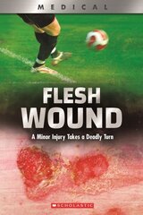 Flesh Wound (Xbooks): A Minor Injury Takes a Deadly Turn цена и информация | Книги для подростков и молодежи | 220.lv