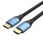 Vention ALHSH, HDMI, 2 m cena un informācija | Kabeļi un vadi | 220.lv