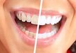 U-Smiler H6P cena un informācija | Elektriskās zobu birstes | 220.lv