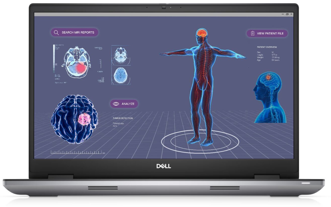 Dell Mobile Precision 7780 (1002216393) cena un informācija | Portatīvie datori | 220.lv