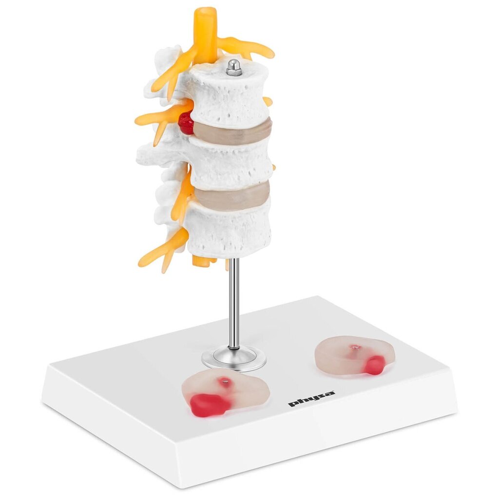Mugurkaula jostas daļas 3D anatomiskais modelis ar trūces skriemeļiem Physa cena un informācija | Attīstošās rotaļlietas | 220.lv