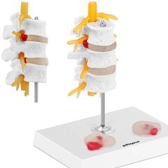 3D анатомическая модель поясничного отдела позвоночника с грыжами 3-5 позвонков цена и информация | Развивающие игрушки | 220.lv