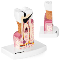 Анатомическая модель больного зуба человека в масштабе 6:1. цена и информация | Развивающие игрушки | 220.lv