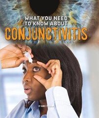 What You Need to Know about Conjunctivitis цена и информация | Книги для подростков и молодежи | 220.lv