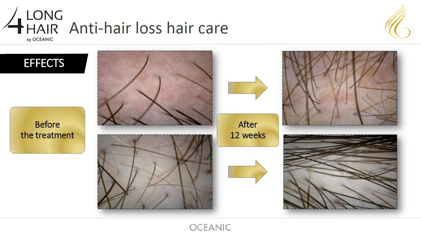 Matu balzams pret matu izkrišanu LONG 4 LASHES 200 ml anti hair loss strengthening conditioner cena un informācija | Matu kondicionieri, balzāmi | 220.lv