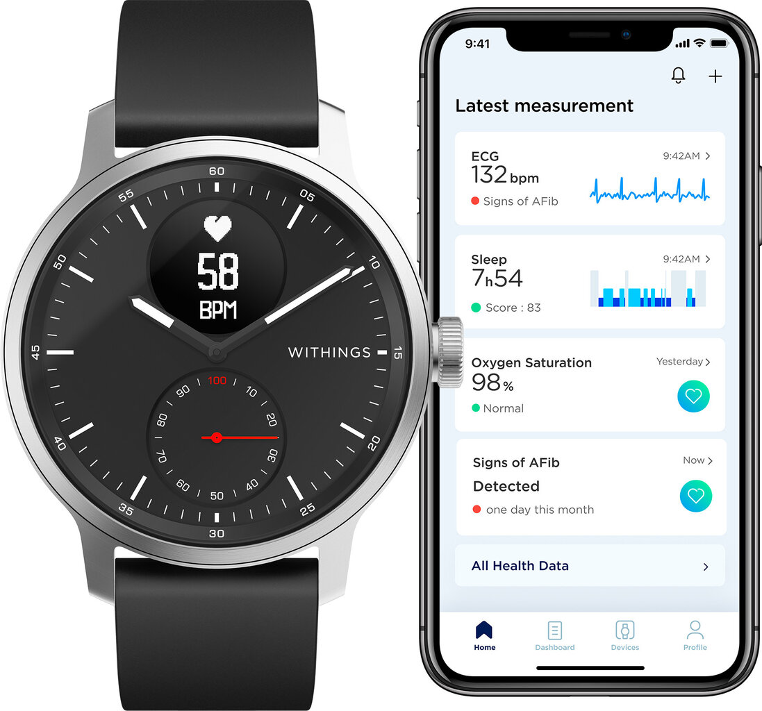 Withings ScanWatch Hybrid Black cena un informācija | Viedpulksteņi (smartwatch) | 220.lv